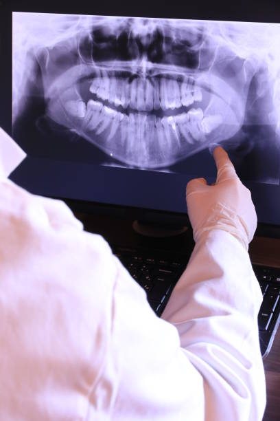 Best Emergency Dentist for Lost Fillings or Crowns in Spencer, TN